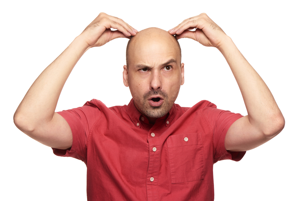 Alopecie