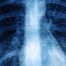 Radiografiile