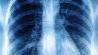 Radiografiile