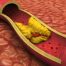 Sistem cardiovascular, Revidox,