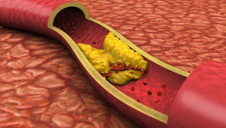 Sistem cardiovascular, Revidox,
