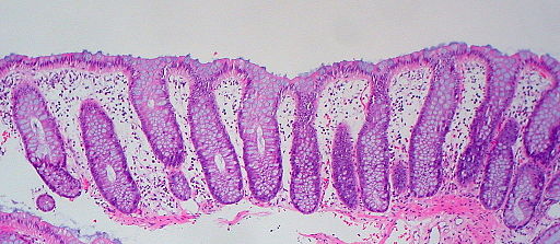 Mucoasa intestinala