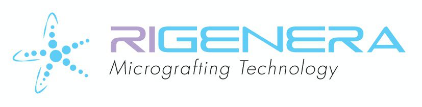 Rigenera, tratament pentru artroza, celule progenitorii,