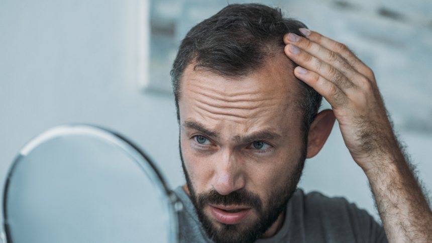 vindecarea alopeciei, Rigenera, celule progenitoare, alopecie,