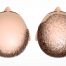 alopecie, celule progenitoare, Rigenera,