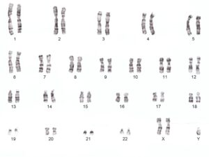 Malformatie genetica