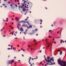 Celule modificate, HPV,