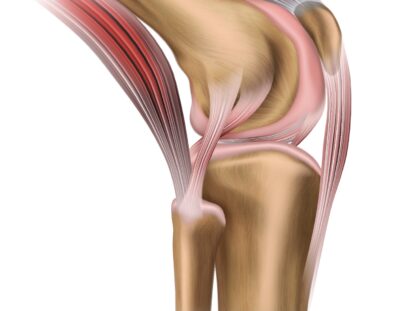 lichidul se acumulează în tratamentul articulației genunchiului