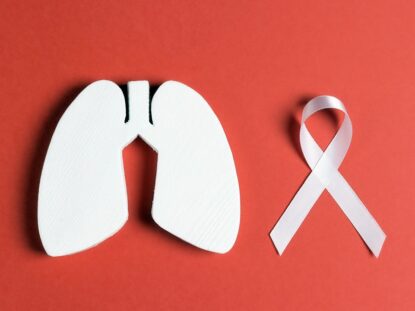 Cancerul pulmonar