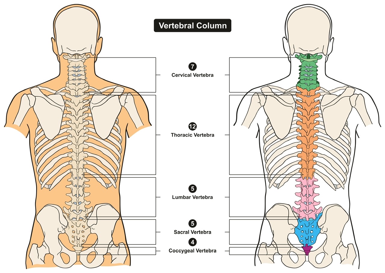 Coloana vertebrala, hernia de disc, 