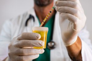 test urina, infectii urinare,