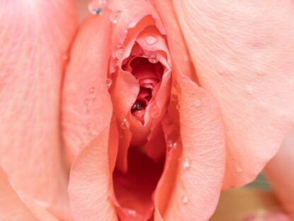 rejuvenarea vaginala, Rigenera,