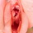 rejuvenarea vaginala, Rigenera,