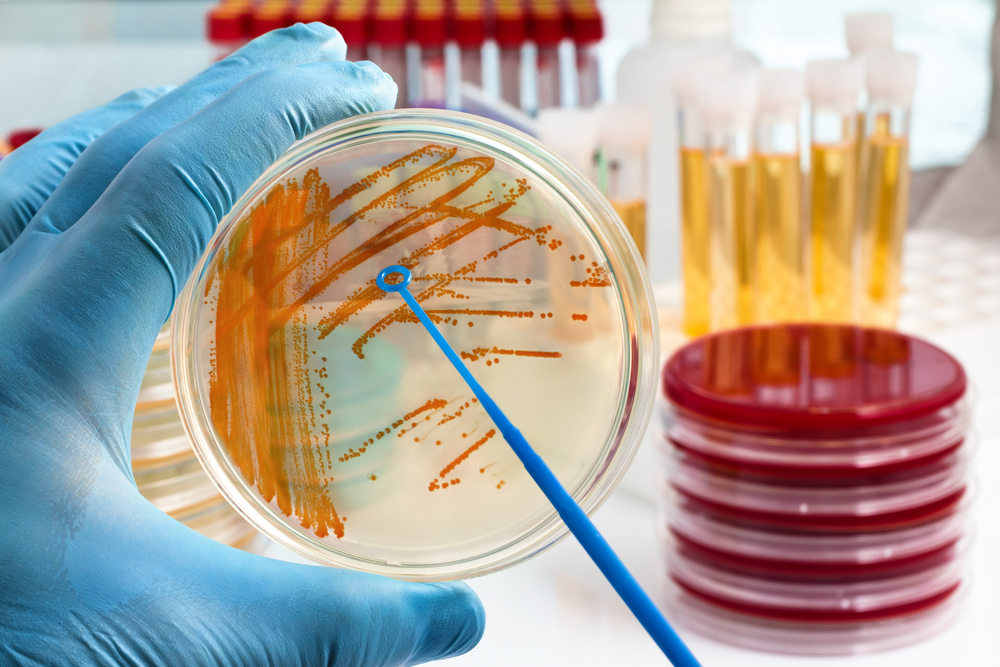 Cultura de bacterii